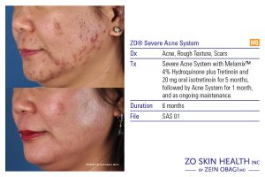 Medical Corrective Skin Products